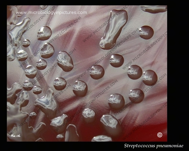 colony morphology of pneumococcus, mucoid form